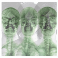 Supergrass, Музыкальный Портал α Supergrass, Музыкальный Портал α